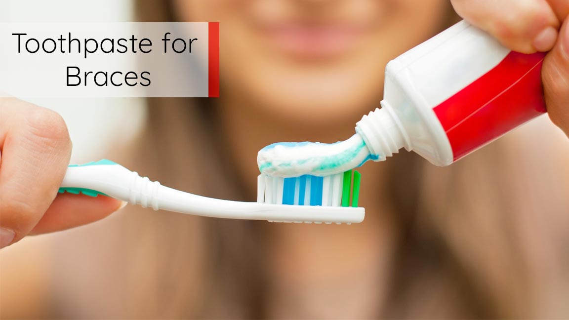 Best Toothpaste for Braces