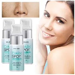 Musely Dark Spot Cream - The Spot Cream for Face